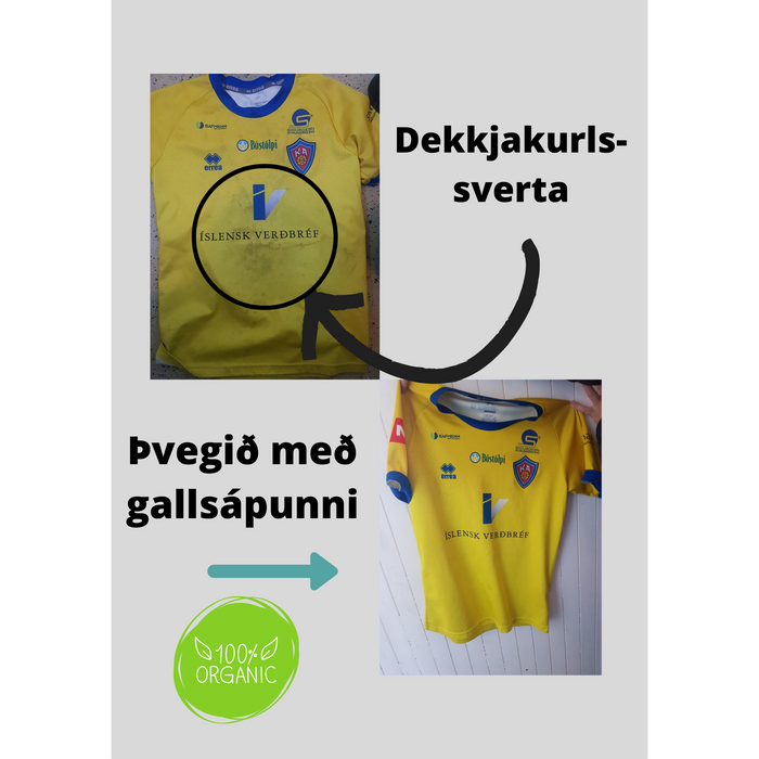 Sodasan Gallsápa / Blettasápa